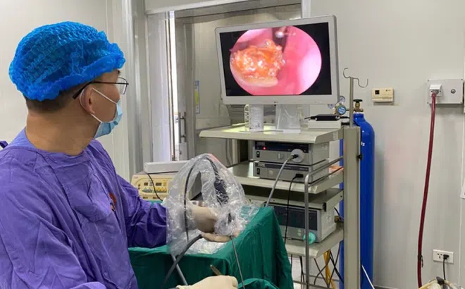 Hy hữu: Bị ngạt, không ngờ có sỏi trong hốc mũi