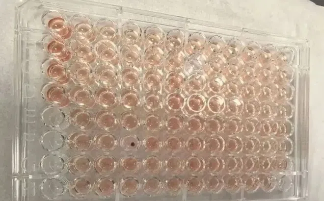 Một người Trung Quốc có 'máu Kim Cương' siêu quý hiếm