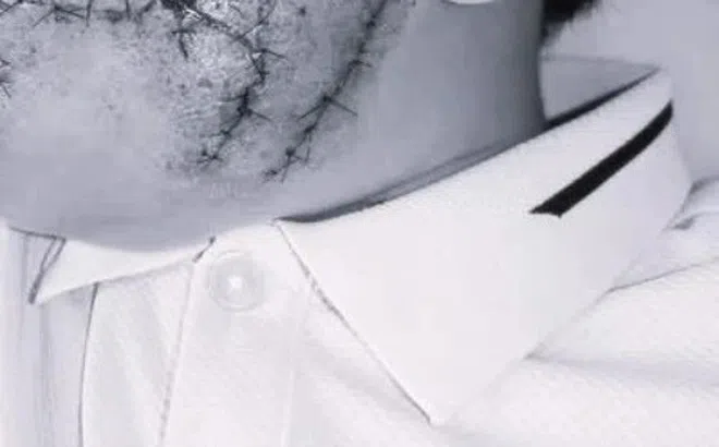 Đang chơi trong sân, bé trai bất ngờ bị chó lạ lao vào cắn