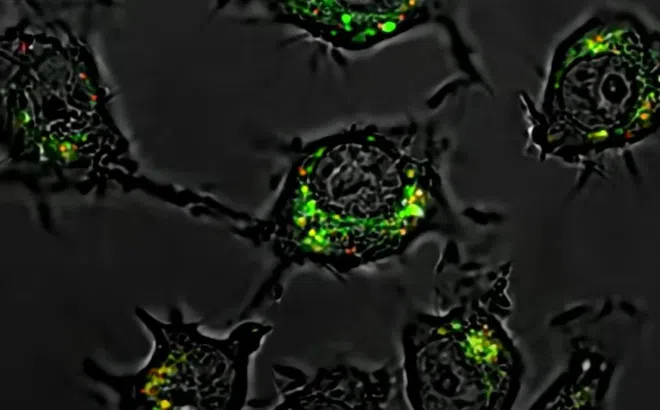 Phát hiện thuốc mới giúp tiêu diệt tế bào ung thư mạnh gấp 20.000 lần