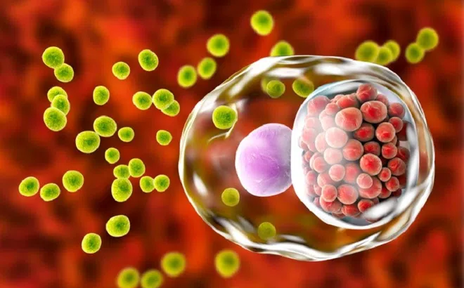 Một bệnh lây qua đường sinh dục nguy hiểm, có thể gây vô sinh