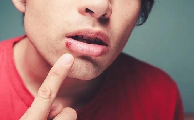 8 dấu hiệu bệnh gan biểu hiện ngay trên mặt